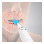 Soniczny Wibrator Logopedyczny + 4 Końcówki - 3