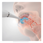 Soniczny Wibrator Logopedyczny + 4 Końcówki - 5